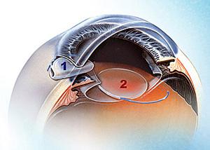 低溫黄瓜视频污污污在线观看人工晶體狀