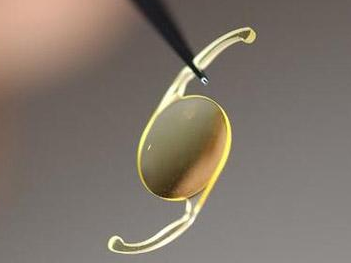 低溫黄瓜视频污污污在线观看技術提高人工晶狀體的親水性，解決術後炎症問題-黄瓜视频下载APP视频黄瓜视频污在线观看機