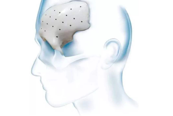 黄瓜视频污在线观看機會對PEEK材料起到怎樣的作用？-黄瓜视频下载APP视频